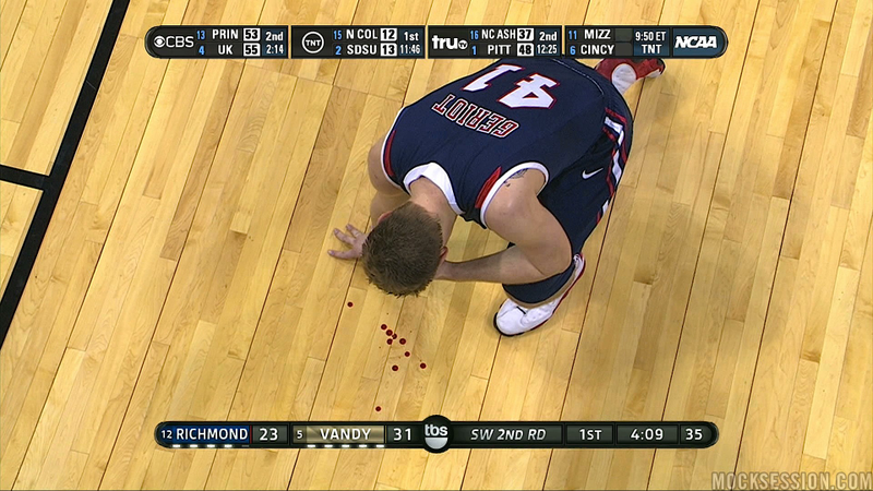 Illustration for article titled Body Parts Do Not Bend That Way: Gruesome Sports Injuries As Seen On TV